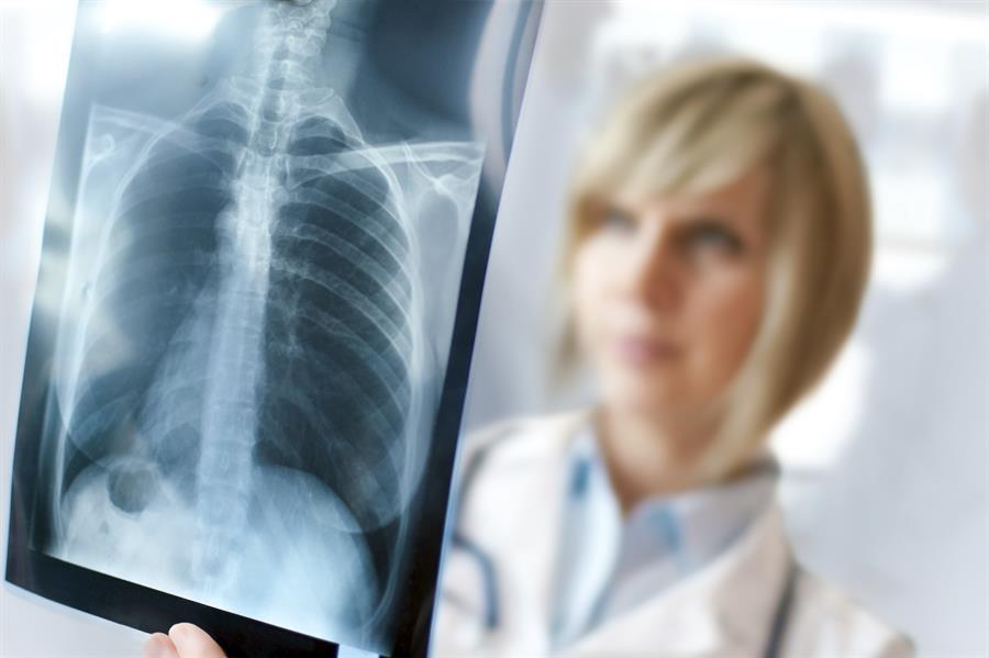 Health care provider reviewing a chest x-ray.