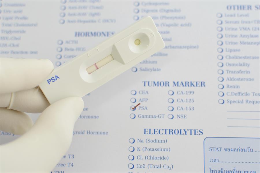 Hand with medical glove on holding a white plastic PSA test stick.