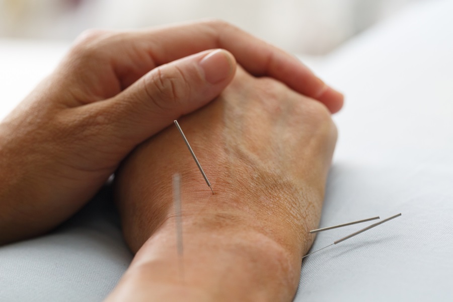 Acupuncture for older adults: The healing touch?