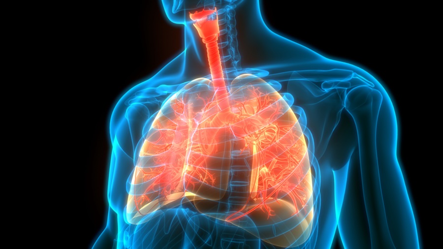 3-D human lungs with inflammation associated with asthma